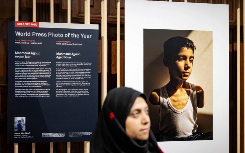 World Press Photo, premiata l’immagine del piccolo Mahmoud