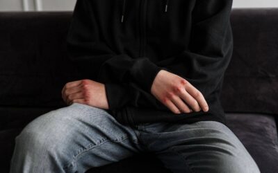 Consulta valuta pene Codice Rosso per lesioni al viso