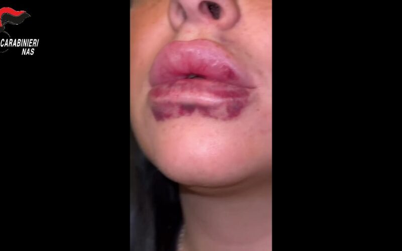 Controlli NAS nei centri estetici [Video], sequestri e denunce