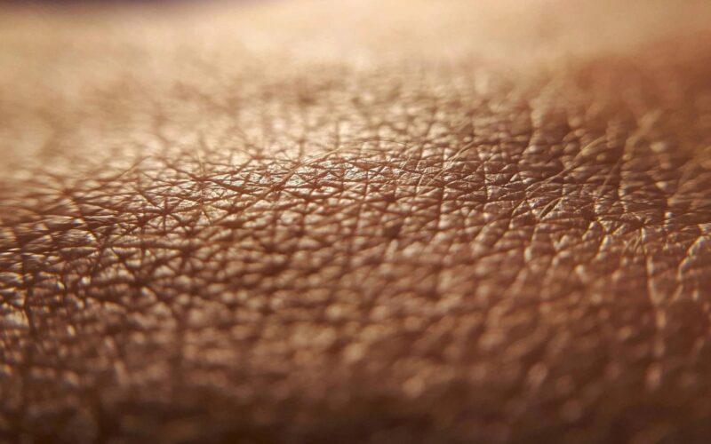 Pelle a rischio con clima estremo e inquinamento crescente