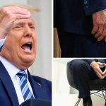 Gambe gonfie per Trump: è insufficienza venosa cronica