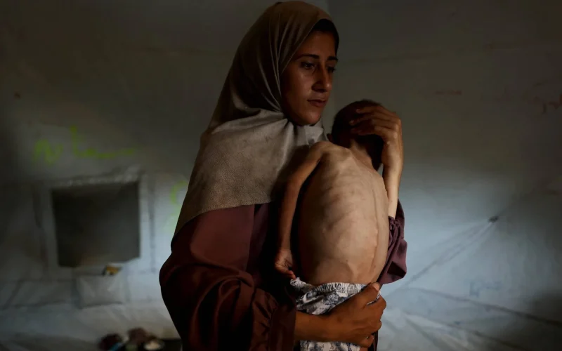 Gaza, chirurgo D’Agostino denuncia malformazioni congenite