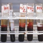 Hiv, il 90% dei pazienti sceglie l'iniezione mensile