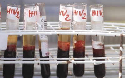 Hiv, il 90% dei pazienti sceglie l'iniezione mensile