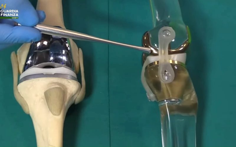 Protesi inesistenti, sequestro da oltre un milione a due società [VIDEO]