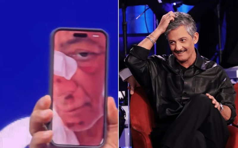 Fiorello cade in bici a Roma tentando una manovra azzardata